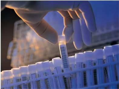 Temperature monitoring during the transport of biological samples Biological USB